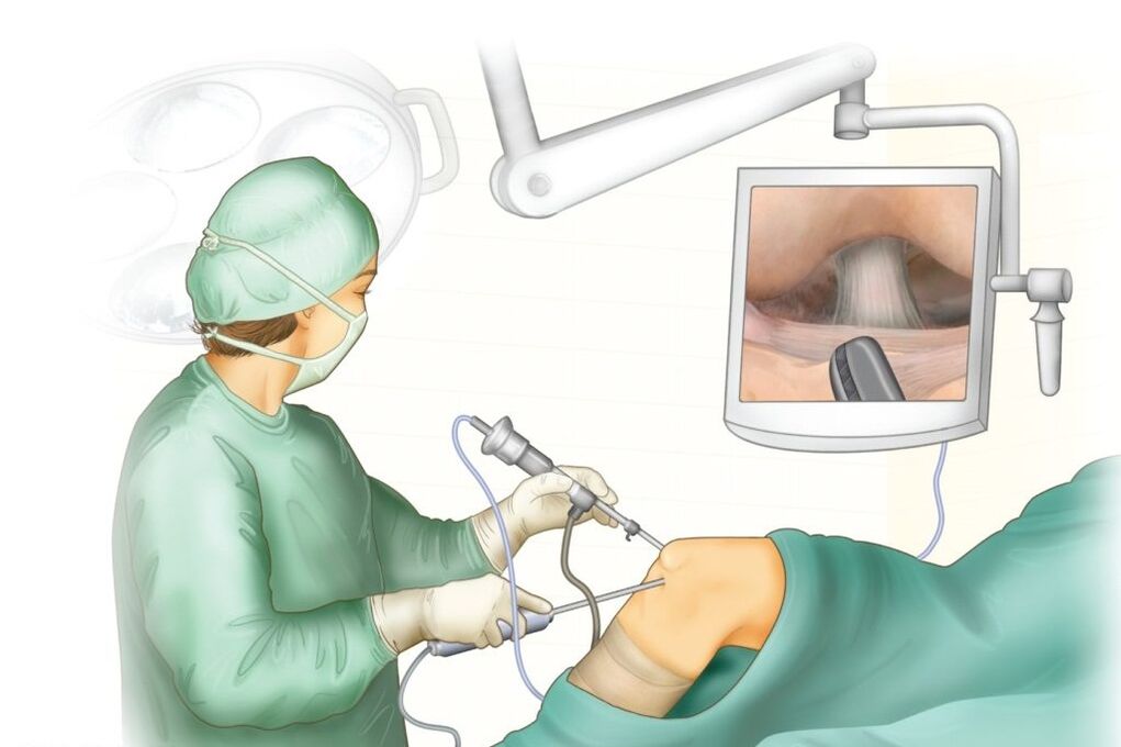 Chirurgie articulară la genunchi