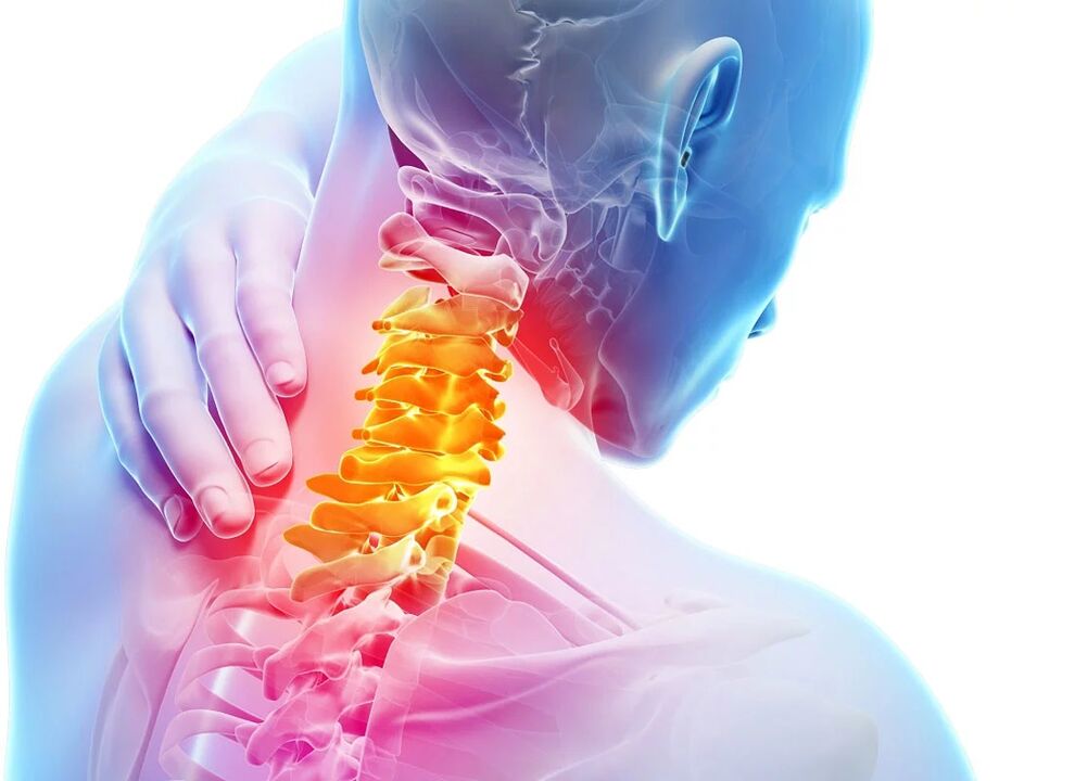 Osteochondroza cervicală