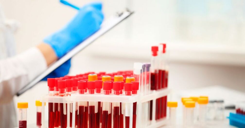 Efectuarea unui test de sânge pentru a detecta inflamația